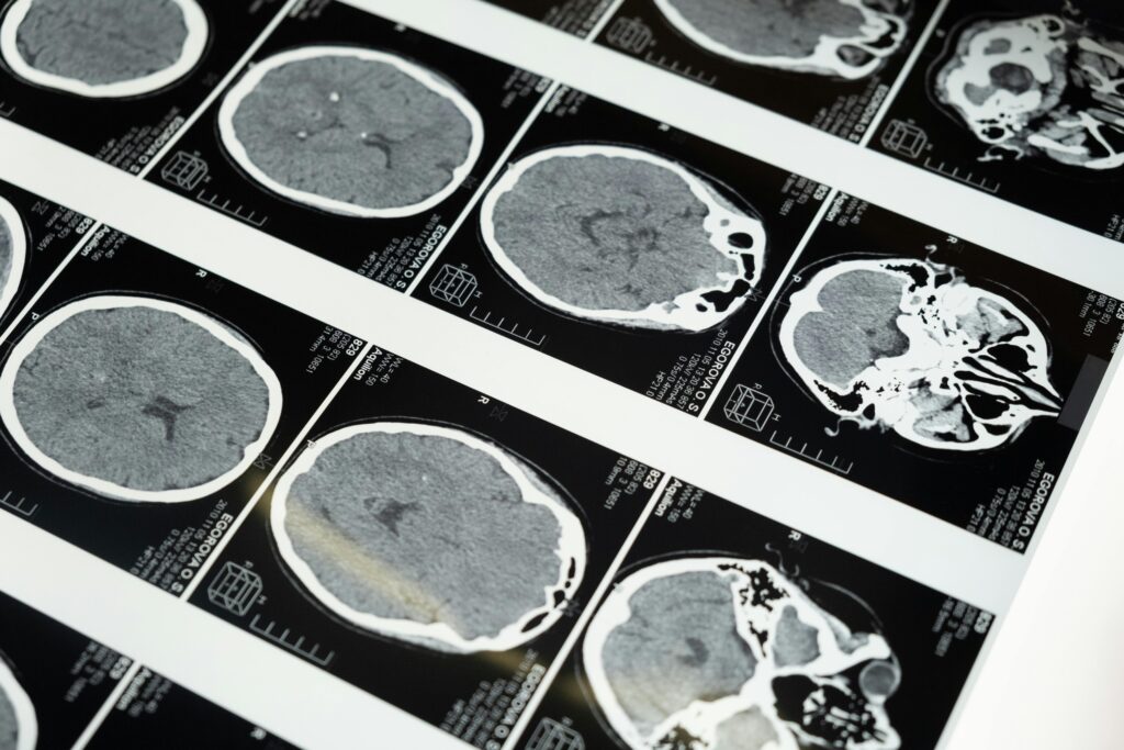 Ricerca scientifica sui deficit cognitivi Pexels Photo 5723883 5723883 1024x683